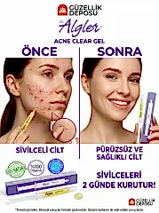 Dr. Algler Acne Clear Gel - Sivilce Karşıtı Kurutucu Jel 10 ml - 2 Günde Etkili %100 Organik Yosun Özlü Bakım